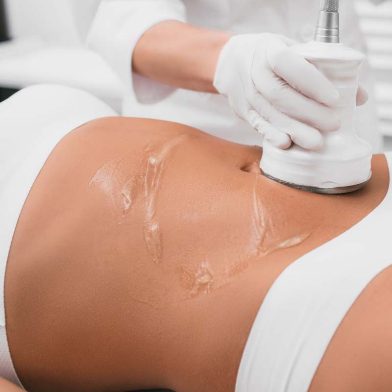 Ultrasonic Fat Cavitation is a non-surgical treatment